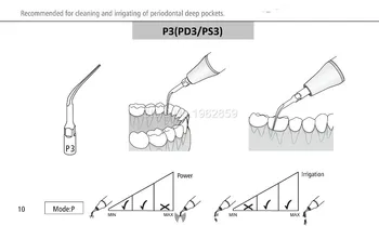 5шт P3 зъбни скалерные уши стоматологично оборудване ултразвуков скалер съвет P3 зъболекарски инструмент за избелване на зъбите, за да EMS и на кълвача